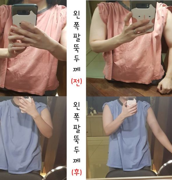 약손명가, 왜 그렇게 유명한지 해보고 알았습니다!!!