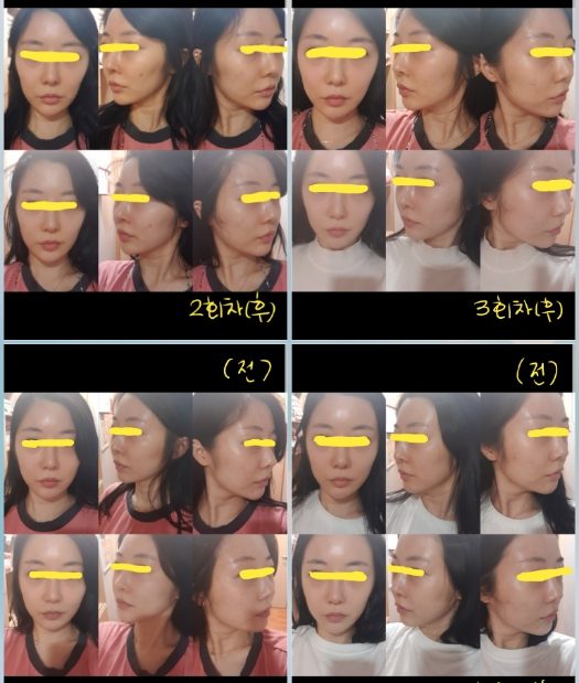 약손명가로 평생 인생사진 남길수있어요~!