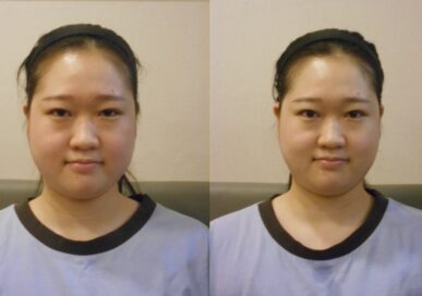 [Face Resizing Care] Kim Yu-Jin