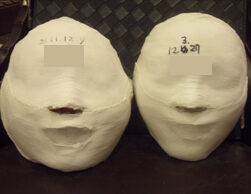 Busan Seomyeon Before and After 20 Sessions