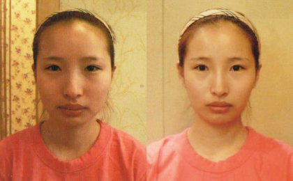 14.임한솔-고객님턱집중.png