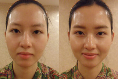 [Small Face Care] Lee Seul, Dongdaemun branch