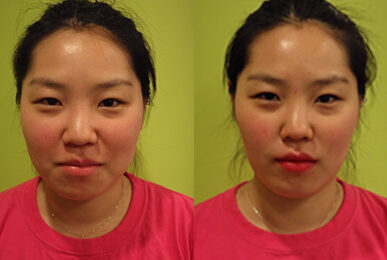 [Small Face Care] Lee Bo-Ram, Sadang branch