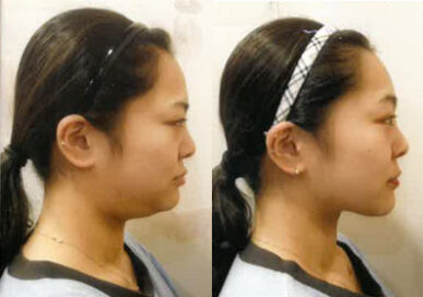 [Double Chin Care] Lee Chae-Yeon, Mangwon branch