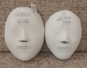 [Small Face Care]  Dongtan Naru Before and After 20 sessions