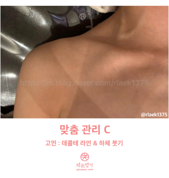 타에스테틱과는 차원이 다른 약손명가일산킨텍스점 웨딩관리 후기