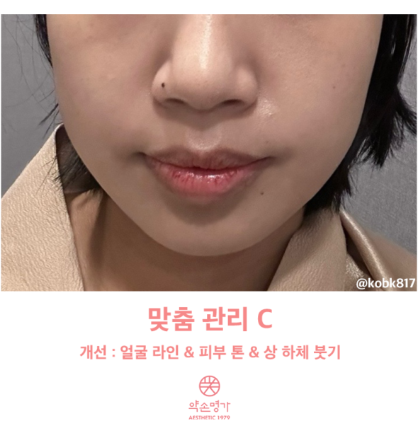 약손명가 찐후기 전신 맞춤관리로 얼굴, 바디 고민 해결