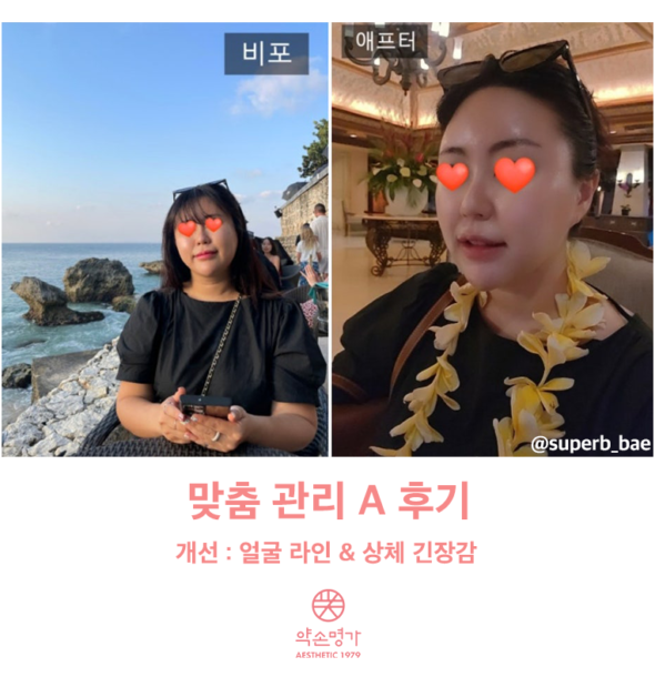 약손명가 솔직후기 :: 명동점에서 맞춤관리 받았어요!