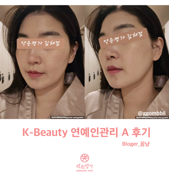 [약손명가 솔직 후기] 김해점에서 연예인 관리 받아본 후기 + 비포애프터