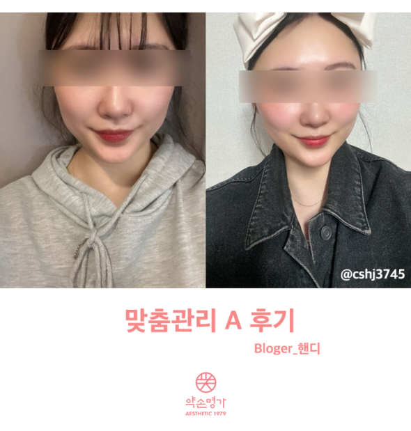 약손명가 맞춤관리받고 바로 고민 개선된 솔직후기 ㅣ 약손명가 창원점