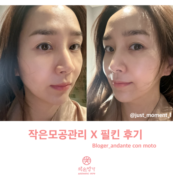 관리 1회 만에 고민 해결! 약손명가 송파헬리오시티점 솔직 후기