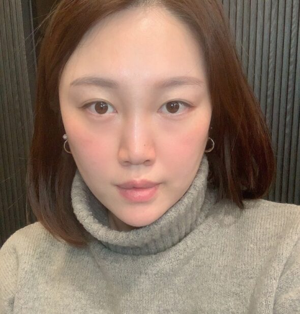 약손명가 한티역점 작은 얼굴 프로그램으로 이중턱 해결