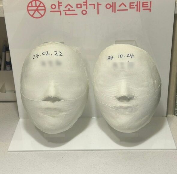 신사피부관리 약손명가 논현점 작은얼굴관리 솔직후기